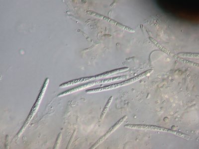 [Bactrospora thyrsodes]